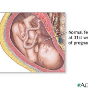 Zwangerschap week 31