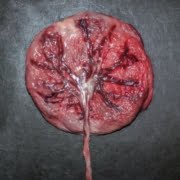 placenta eten