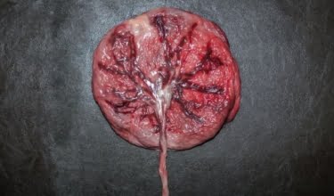 placenta eten