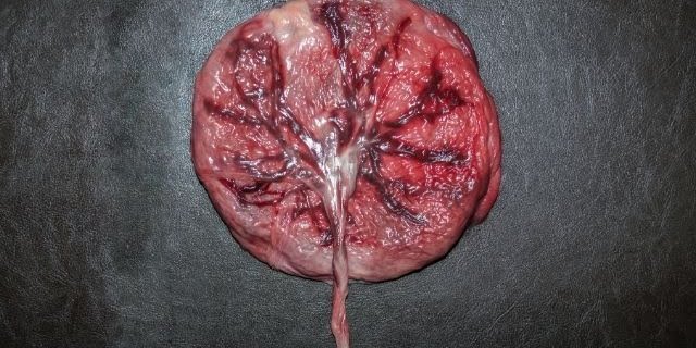 placenta eten