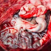 placenta