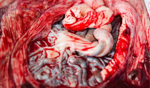 placenta