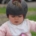 Schedelafwijkingen bij baby’s wanneer kies je voor een redressiehelm